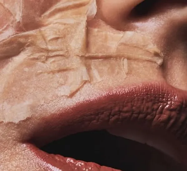 Close-up of dry, cracked lips and skin
